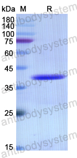 Recombinant Human CD172a/SIRPA Protein, N-His