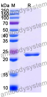 Recombinant Human CD156a/ADAM8 Protein, N-His