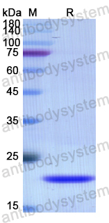 Recombinant Human PITX1 Protein, N-His-SUMO