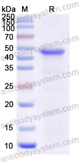 Recombinant Human ASIC1 Protein, N-His