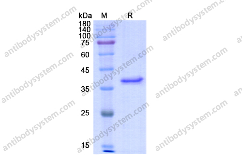 Recombinant Human DLG4/PSD95 Protein, N-His