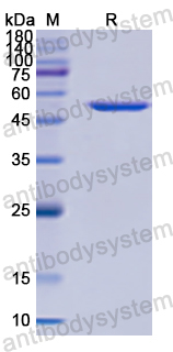 Recombinant Human CCT2 Protein, N-His