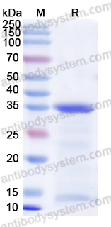 Recombinant Human CD156b/ADAM17 Protein, N-His