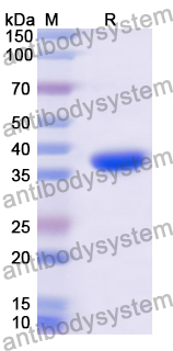 Recombinant Human CD213a1/IL13RA1 Protein, N-His