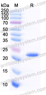 Recombinant Human LCN2/NGAL Protein, C-His