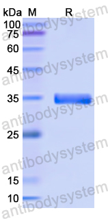 Recombinant Human HSD11B2 Protein, N-His