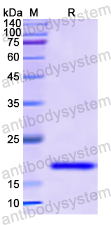 Recombinant Human RBP5 Protein, N-His