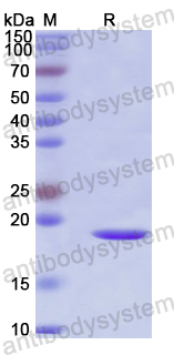 Recombinant Human CBX1 Protein, N-His