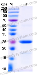 Recombinant Human SMAD3 Protein, N-His