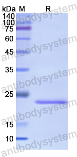 Recombinant Human HPCA Protein, N-His