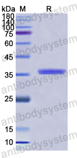 Recombinant Human VLDLR Protein, N-His