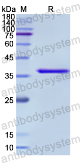 Recombinant Human NFKB2 Protein, N-His
