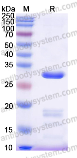 Recombinant Human FKBP3 Protein, N-His