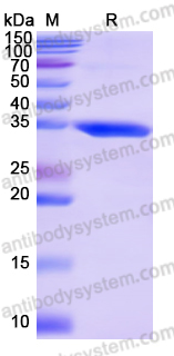 Recombinant Human U2AF1 Protein, N-His