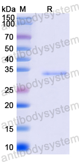 Recombinant Human SPTBN1 Protein, N-His
