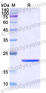 Recombinant Human E2F1 Protein, N-His