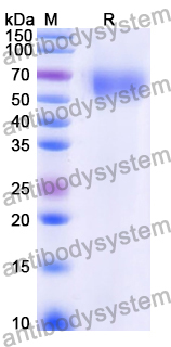Recombinant Human RUNX1 Protein, N-His-SUMO