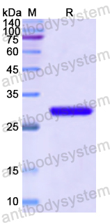 Recombinant Human RELB Protein, N-His
