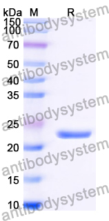 Recombinant Human AMPD3 Protein, N-His