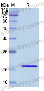 Recombinant Human MYL7 Protein, N-His
