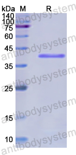 Recombinant Human CTBS Protein, N-His