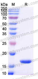 Recombinant Human FABP5 Protein, N-His