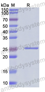 Recombinant Human EXOSC10 Protein, N-His