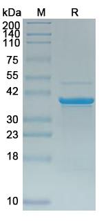 Recombinant Human OTUD4 Protein, N-His