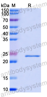 Recombinant Human SATB1 Protein, N-His-SUMO