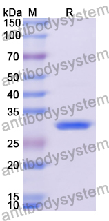 Recombinant Human SLC6A3 Protein, N-His-KSI