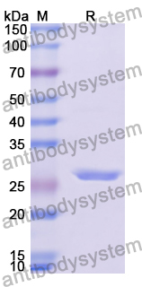 Recombinant Human GUCY1A1 Protein, N-His
