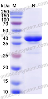 Recombinant Human DHODH Protein, N-His