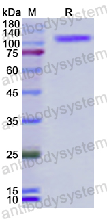 Recombinant Human DST/Dystonin Protein, N-His