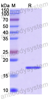 Recombinant Human ROM1 Protein, N-His