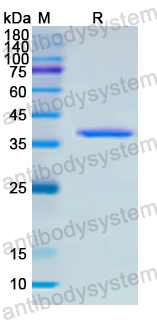 Recombinant Human FOLH1 Protein, N-His