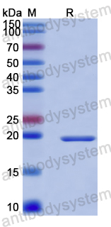 Recombinant Human GLO1 Protein, N-His