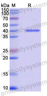 Recombinant Human CSTF1 Protein, N-His