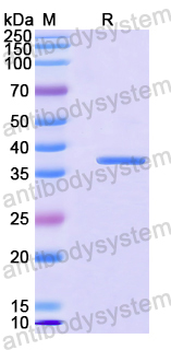 Recombinant Human SLC18A2 Protein, N-GST & C-His