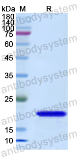 Recombinant Human BTK Protein, N-His