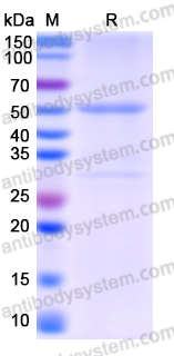 Recombinant Human PPAT Protein, N-His