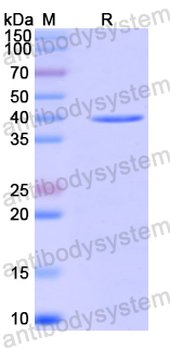 Recombinant Human GFPT1 Protein, N-His