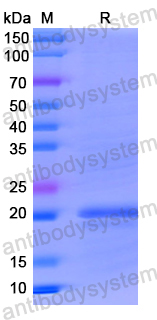 Recombinant Human AOX1 Protein, N-His