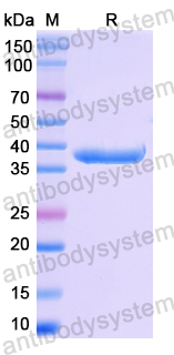 Recombinant Human RBPJ Protein, N-His