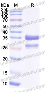 Recombinant Human SULT2A1 Protein, N-His