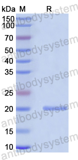 Recombinant Human GABPB1 Protein, N-His