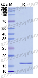 Recombinant Human PAX8 Protein, N-His