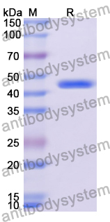 Recombinant Human EGR3 Protein, N-His-KSI