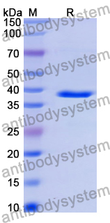 Recombinant Human PDE4B Protein, N-His