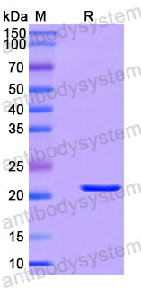 Recombinant Human KHDRBS1 Protein, N-His
