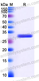 Recombinant Human BCL2L1 Protein, C-His
